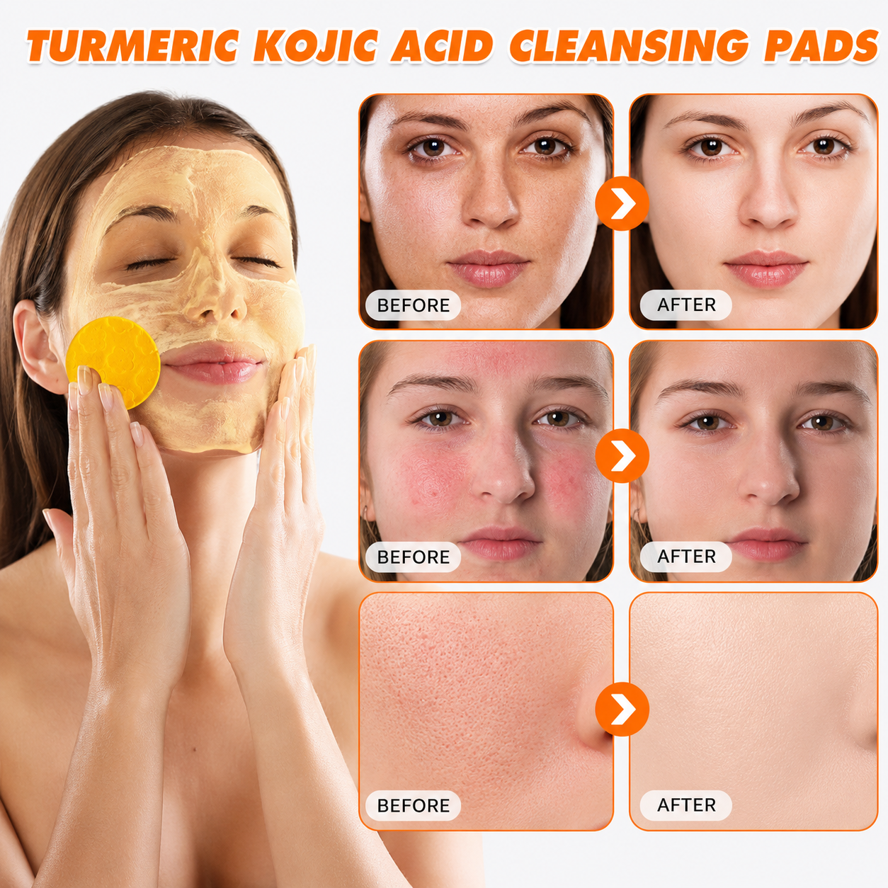 Skinovae Turmeric Kojic Glow Pads
