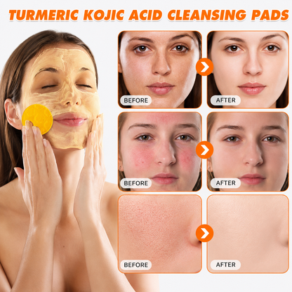 Skinovae Turmeric Kojic Glow Pads